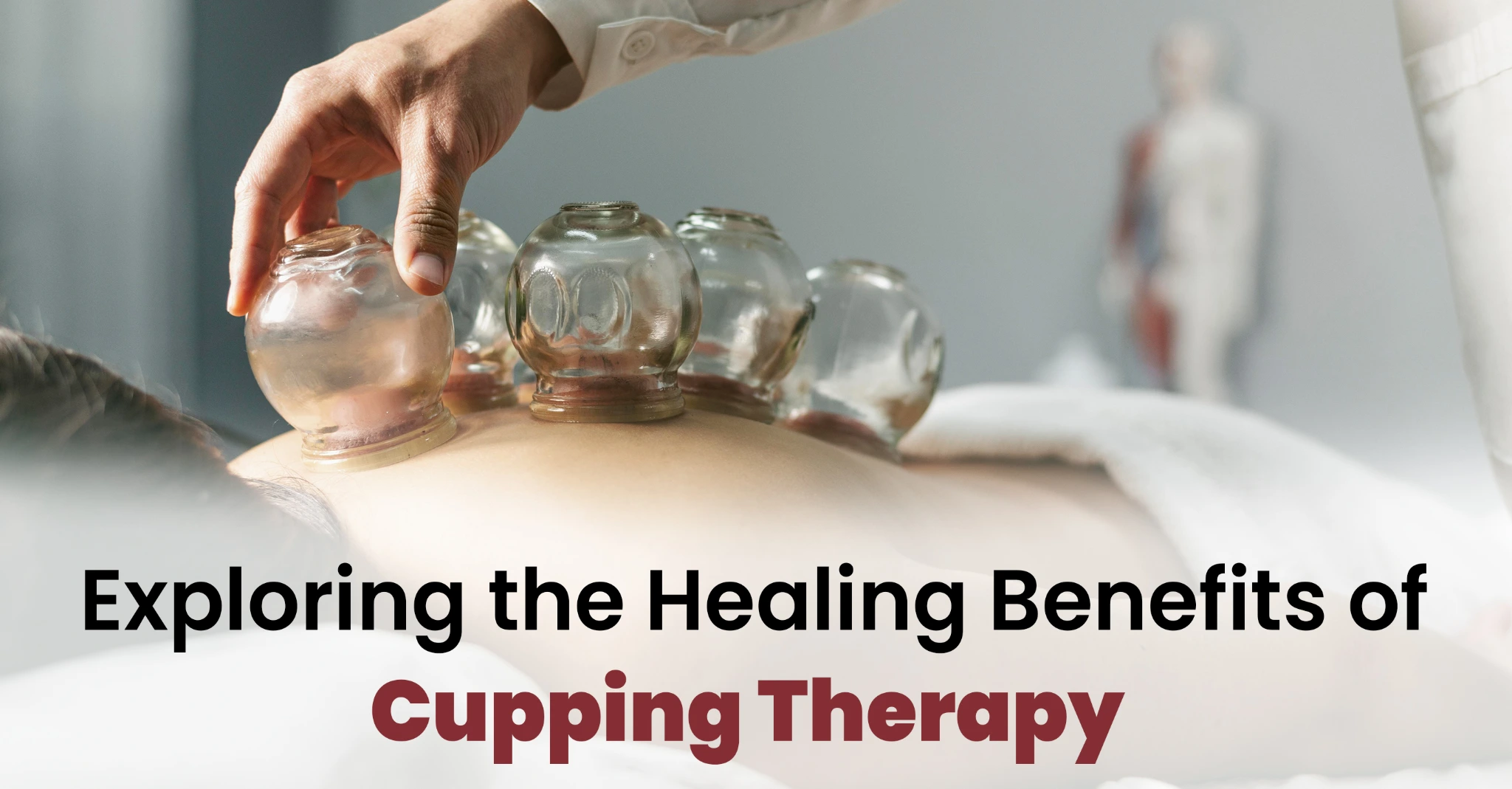 cupping therapy, cupping therapy near me