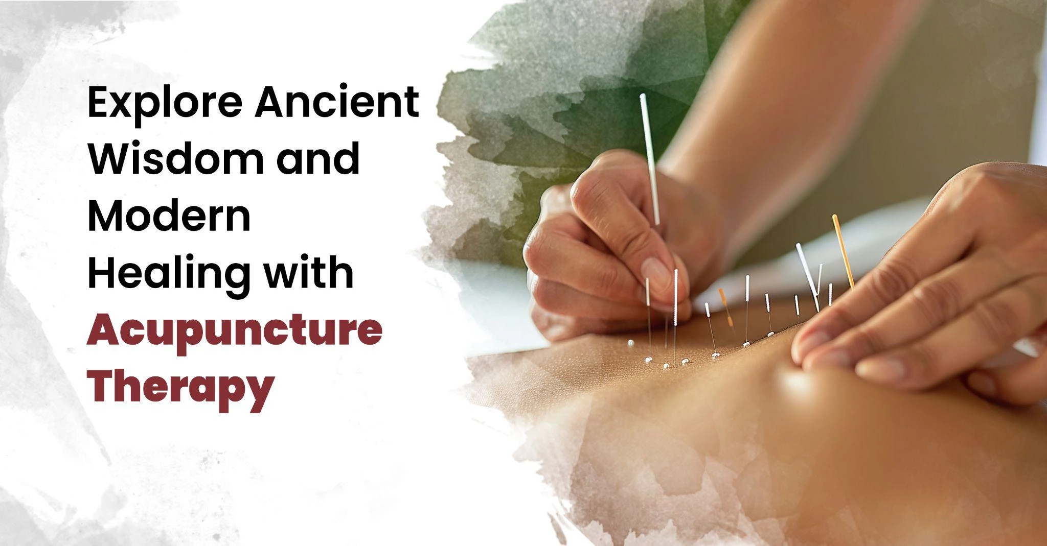 acupuncture therapy near me, acupuncture therapy benefits