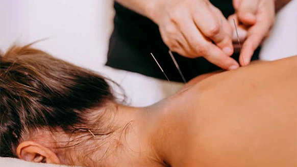 acupuncture near me