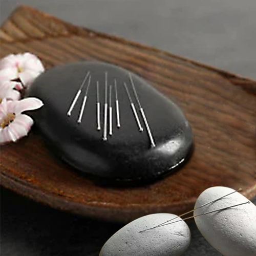 acupuncture near me
