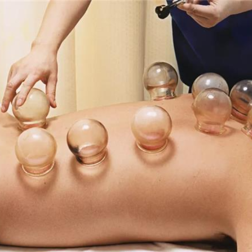 cupping therapy session