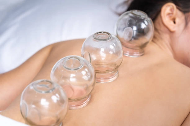 Cupping therapy equipments