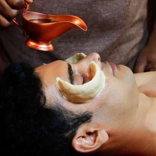 netra-tarpan-procedure-showing-ghee-reservoir-around-eyes